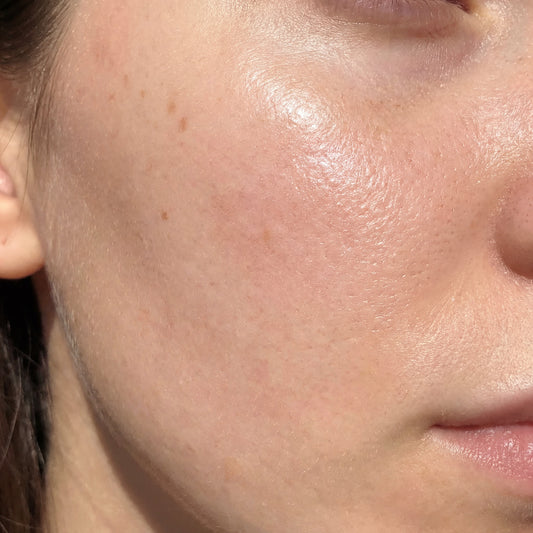 The Truth About Textured Skin: How to Finally Clear Clogged Pores